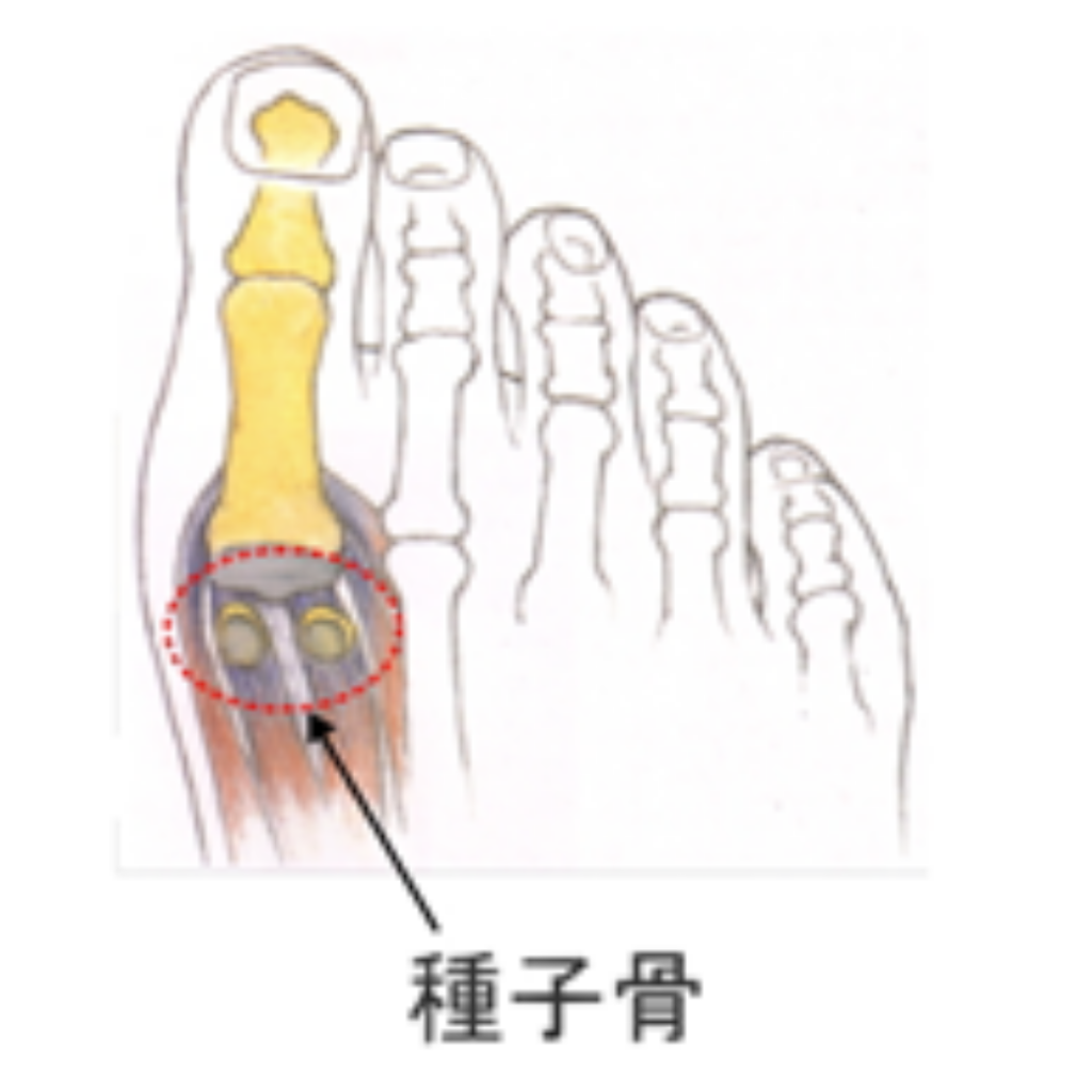 足の痛み種子骨の治療は八女整骨院なかきどへご来院ください